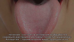 Красная мелкая сыпь на языке у ребенка — причины появления
