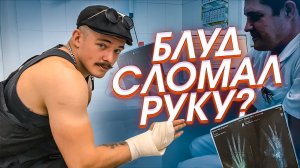 БЛУД СЛОМАЛ РУКУ?