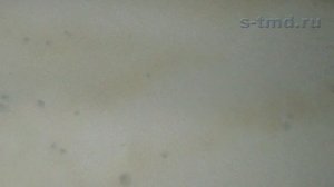 Гипсовая штукатурка что делать чтобы не появился грибок. Профилактика от плесени