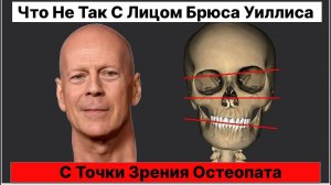 Что не так с лицом Брюса Уиллиса с точки зрения остеопата #остеопатия #массаж #москва