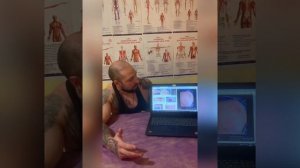 Синяки после массажа, хорошо это или плохо?!