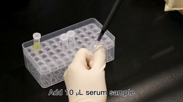 Aspergillus IgG/ IgM Antibody Detection K-Set(Lateral Flow Assay)-Era Biology смотреть онлайн
