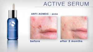 ACTIVE SERUM