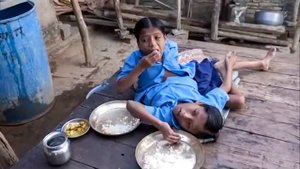 Лучшие видео 5 СИАМСКИХ БЛИЗНЕЦОВ  В СУЩЕСТВОВАНИЕ КОТОРЫХ НЕВОЗМОЖНО ПОВЕРИТЬ!1