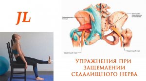 Упражнения при защемлении седалищного нерва. Ишиас.