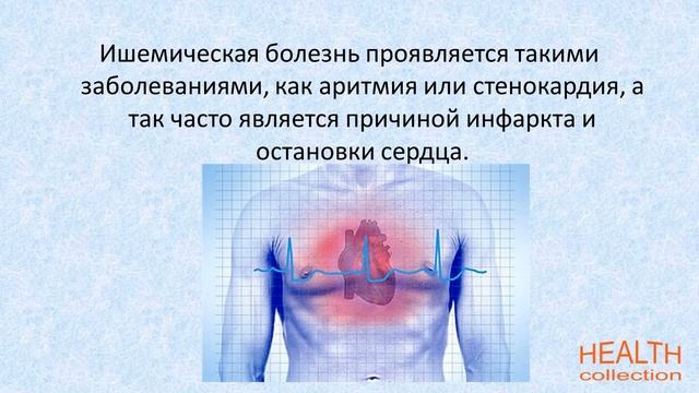 Ишемическая болезнь сердца смотреть онлайн