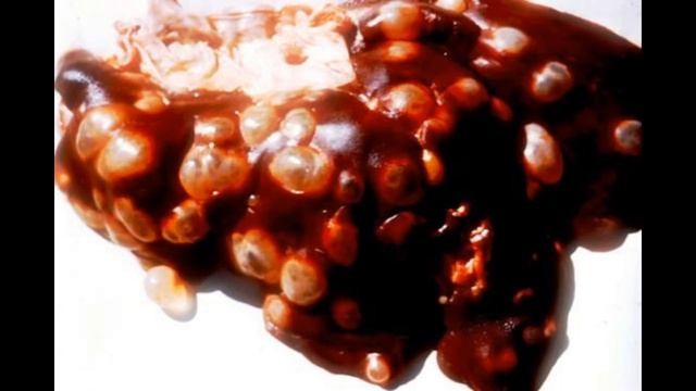 Инфицирование происходит при поглощении личинок ...  Суворовское училище