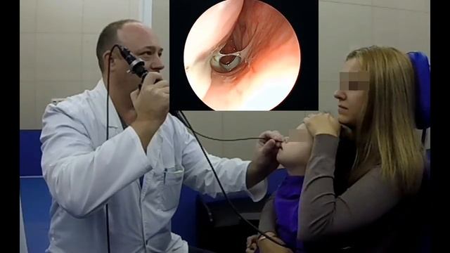 Острый гнойный двусторонний  риносинусит.mp4 смотреть онлайн