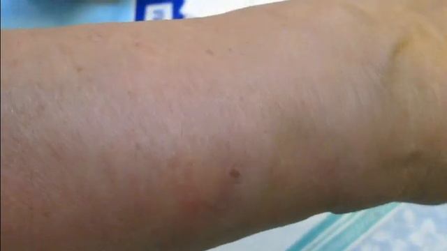 БГВ 77 Чёрная Львинка Борщевик. Защита (часть 3) смотреть онлайн