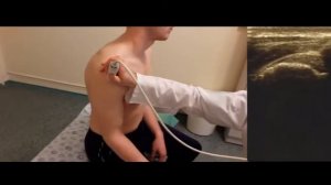 Технология ультразвукового исследования плечевого сустава