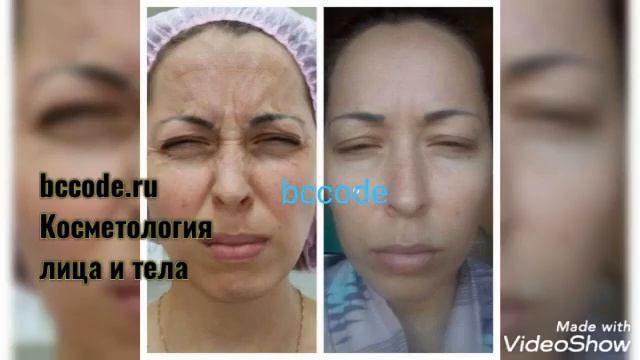 Мезонити москва