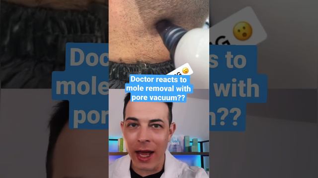 Insane way to remove a mole! | 208SkinDoc