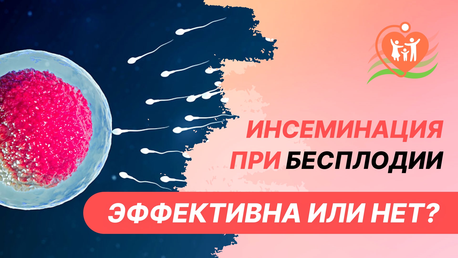 ? Инсеминация при бесплодии - эффективна или нет?