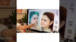 Как проводится подтяжка лица