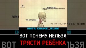 Вот почему нельзя трясти ребёнка?