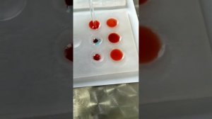 Определение группы крови по системе АВ0, системе резус