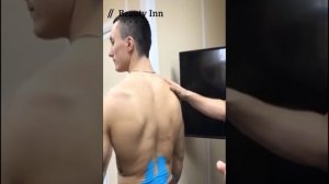 Кинезиологическое тейпирование. Техника апплицирования. Китайский фонарик. Эфир 10.26