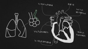 Открытый артериальный проток