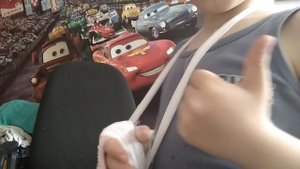 перелом руки! + опухло два пальца смотреть до конца жесть!!!!!!!