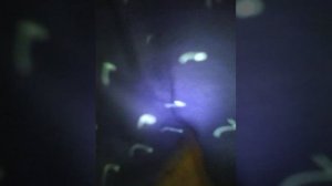 Стридорозное? Дыхание у ребёнка.