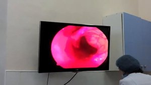 Эндоскопическое  удаление голосовых связок у собаки