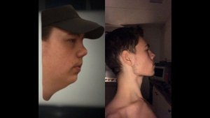 Mewing before and after. Mewing по русски. Результат до и после
