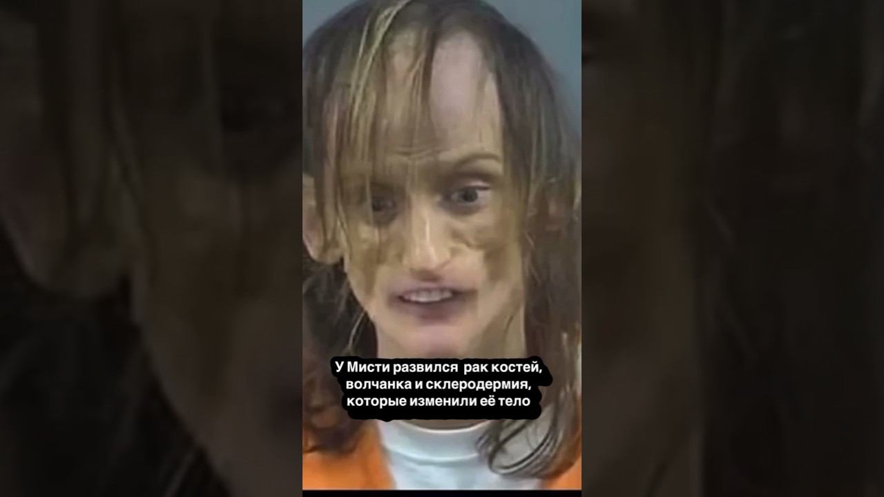 ХУДШИЙ результат УПОТРЕБЛЕНИЯ наркотиков в МИРЕ #shorts смотреть онлайн