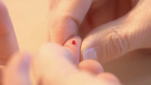 MADx ALEX 2 Flexible.Reliable.Affordable смотреть онлайн