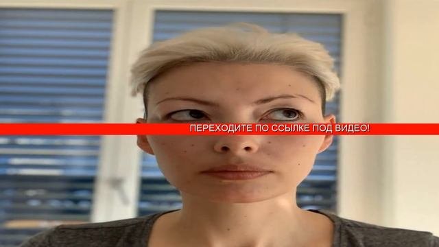 Отеки на глазах верхнее веко как избавиться