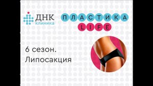 6 сезон. 1 серия. ПЛАСТИКА-Life. Александра. Липосакция