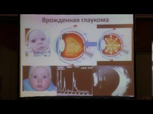 Ультразвуковые методы диагностики в детской офтальмологии