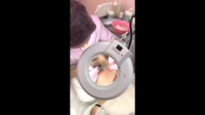 Механическая чистка лица. Фрагмент удаления черных точек с крыльев носа