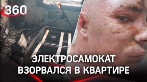 Электросамокат взорвался в квартире пермяка. Молодой человек снял последствия на видео