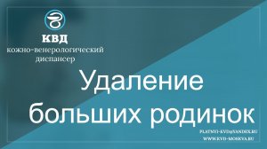 232  Удаление больших родинок