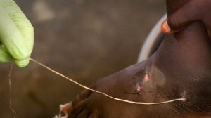 10 САМЫХ ДОЛГОЖИВУЩИХ ПАРАЗИТОВ