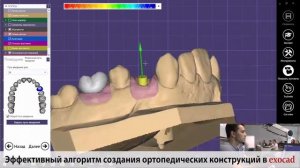 Практический курс М. Ашортиа. Алгоритм создания ортопедических конструкций в программе EXOCAD