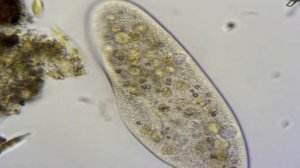 Инфузория туфелька под микроскопом    Paramecium caudatum under the microscope