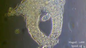 Amoeba eats  paramecia ( Amoeba's lunch ) [ Amoeba Endocytosis / Phagocytosis  Part 1 ] ?