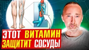 Кальций в сосудах - причина бляшек и тромбов/ как убрать?