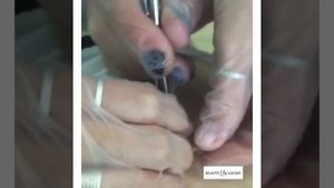 Обучение пирсингу. Курсы в СПб. Практика. Прокол пупка