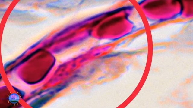 ВРЕД СОЛИ смотреть онлайн