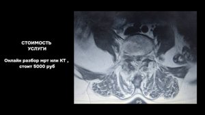 Разбор МРТ пациента | НАУЧИМ И ОБЪЯСНИМ НА ПОНЯТНОМ  ЯЗЫКЕ #костоправ #мрт
