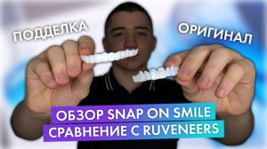 ОБЗОР СЪЕМНЫХ ВИНИРОВ SNAP-ON SMILE | СРАВНЕНИЕ С ИНДИВИДУАЛЬНЫМИ СЪЕМНЫМИ ВИНИРАМИ | RUVENEERS