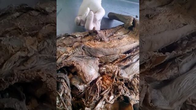 Сосуды головы 1 смотреть онлайн