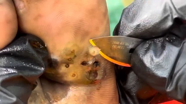 Charles’s very last jigger digging - WORST ATTACK EVER, watch full video @riseupsociety.net смотреть онлайн