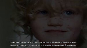 Ацикловир при ветрянке: инструкция по применению