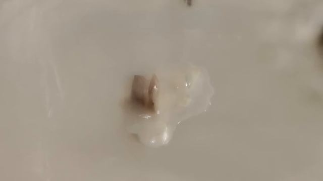 Почки на среде через 3 недели смотреть онлайн