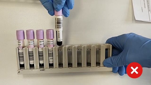 Брегис. Лабораторная информационная система. Правила маркировки контейнеров с биоматериалами. смотреть онлайн