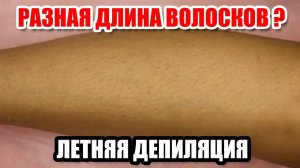 Разная длина волосков. Депиляция летом.