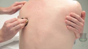 Resp - Auscultation of the Posterior Chest